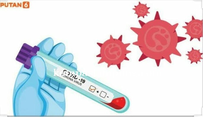 FPII Riau Pertanyakan Penggunaan Dan Pendistribusian Dana Covid-19 Sebesar 115 Miliar